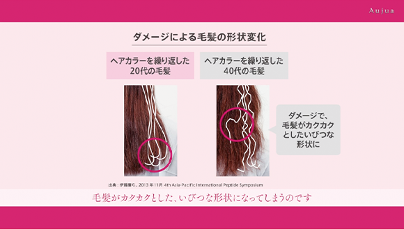 【アイテム】イミュライズ