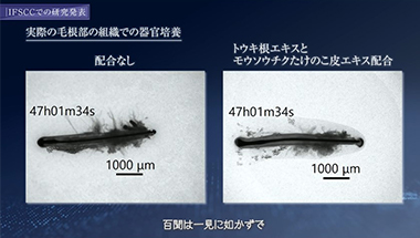【研究解明】スカルプ先端知見インタビュー