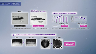 【研究解明】スカルプ先端知見解説